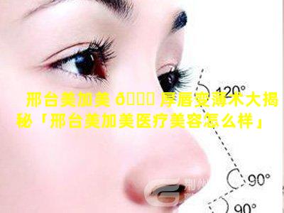 邢台美加美 🐈 厚唇变薄术大揭秘「邢台美加美医疗美容怎么样」